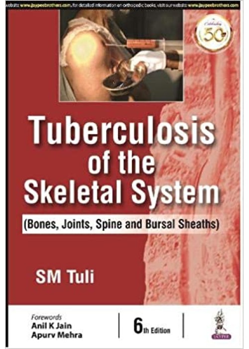 Tuberculosis Of The Skeletal System Tuberculosis Of The Skeletal System